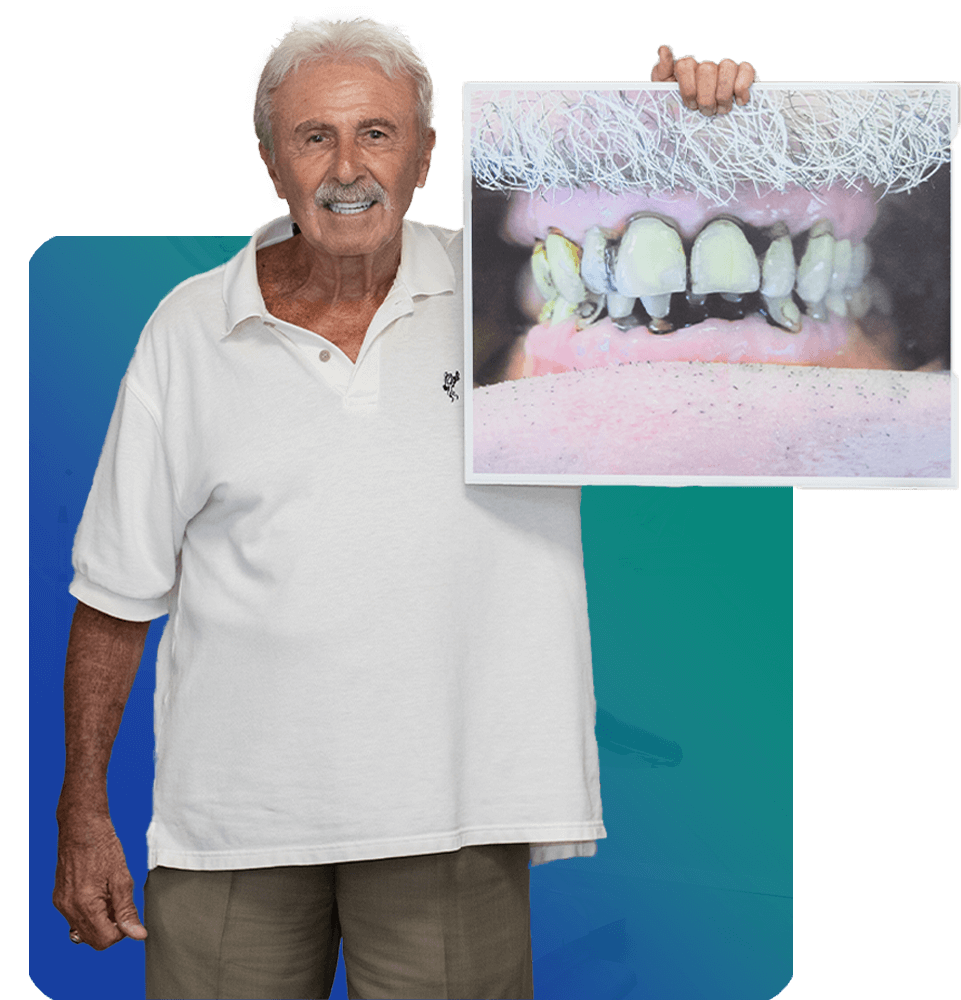 dental implant patient holding up before and after photo