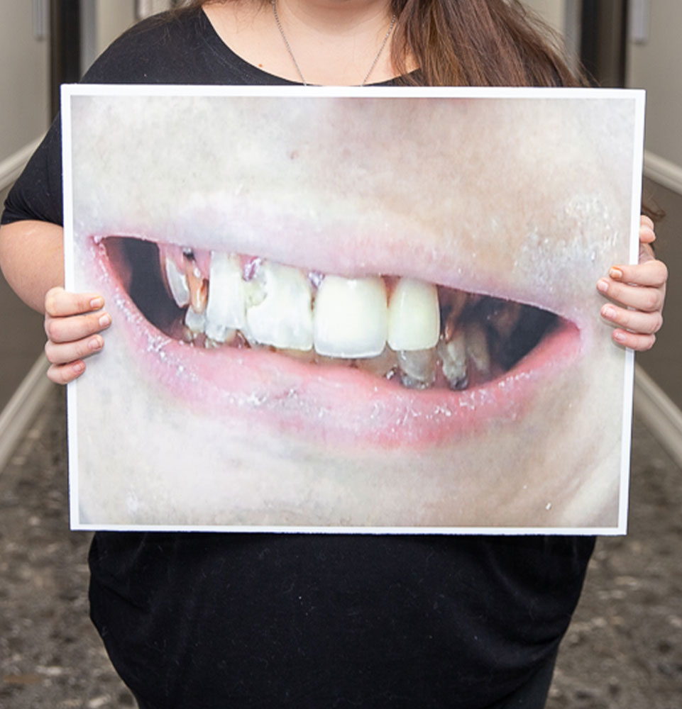 dental veneer candidate holding up photo of herself before procedure